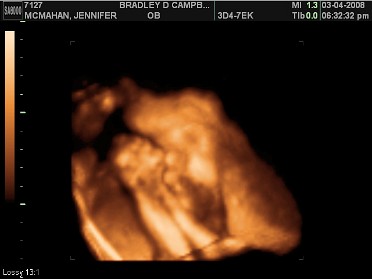 20080306b McMahan Newborn Baby Dean New Baby Peyton