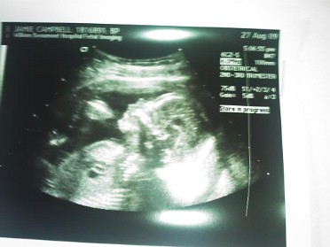 20090827a Campbell Newborn Lily