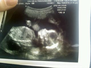 20091104c McMahan Newborn Morgan