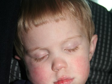 20100304b McMahan Peyton Zonked Out